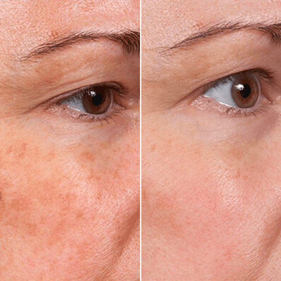 Feature product image